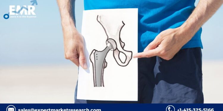 Hip Replacement Implants Market