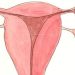 Ectopic Pregnancy