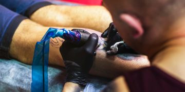 Tattoo Removal Side Effects: What You Should Know Before Taking the Leap